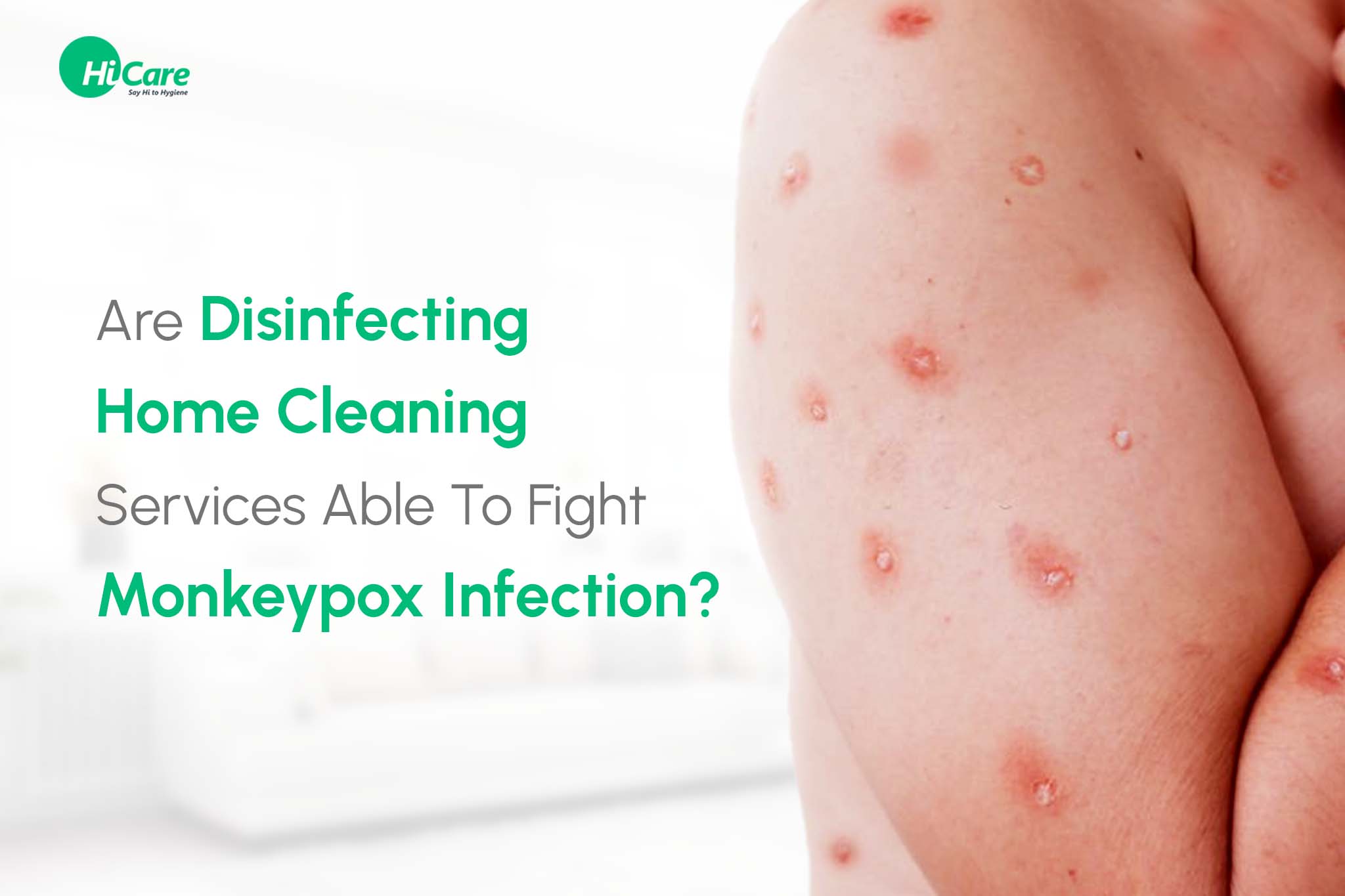 are disinfecting home cleaning services able to fight monkeypox infection