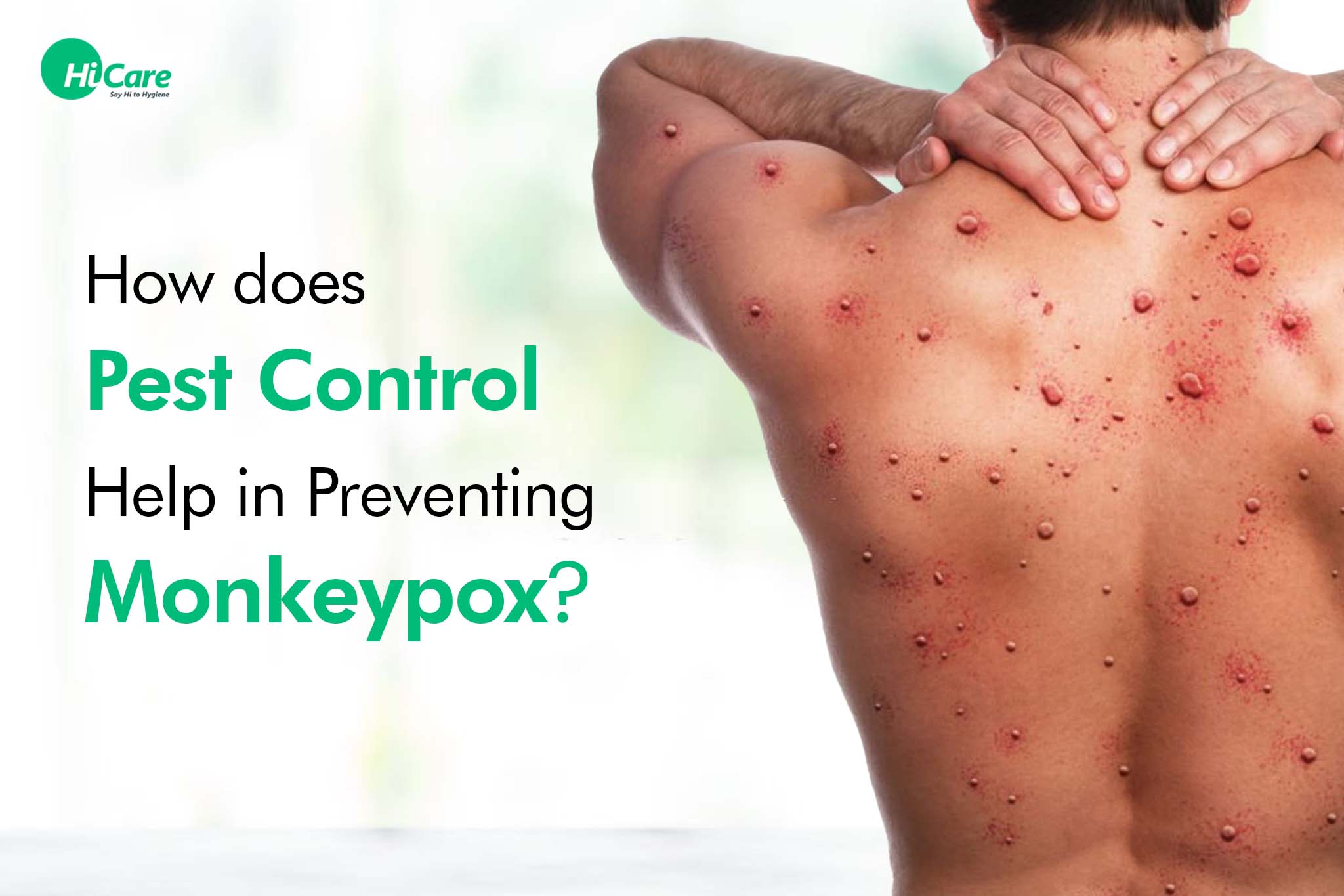 How does Pest Control Help in Preventing Monkeypox?