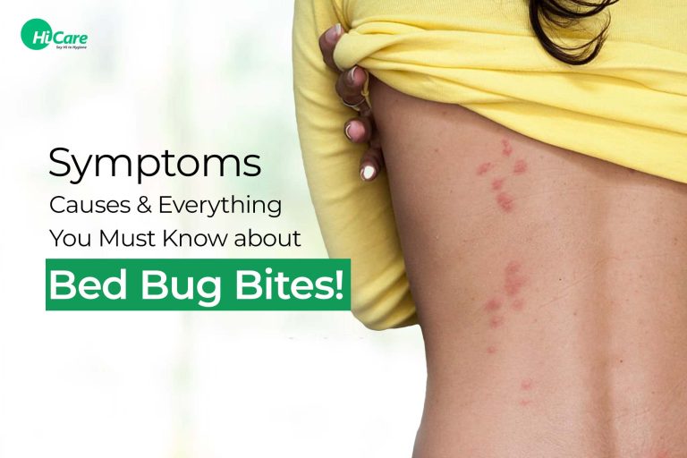 Bed Bugs Bite Symptoms Diagnosis And Treatment HiCare