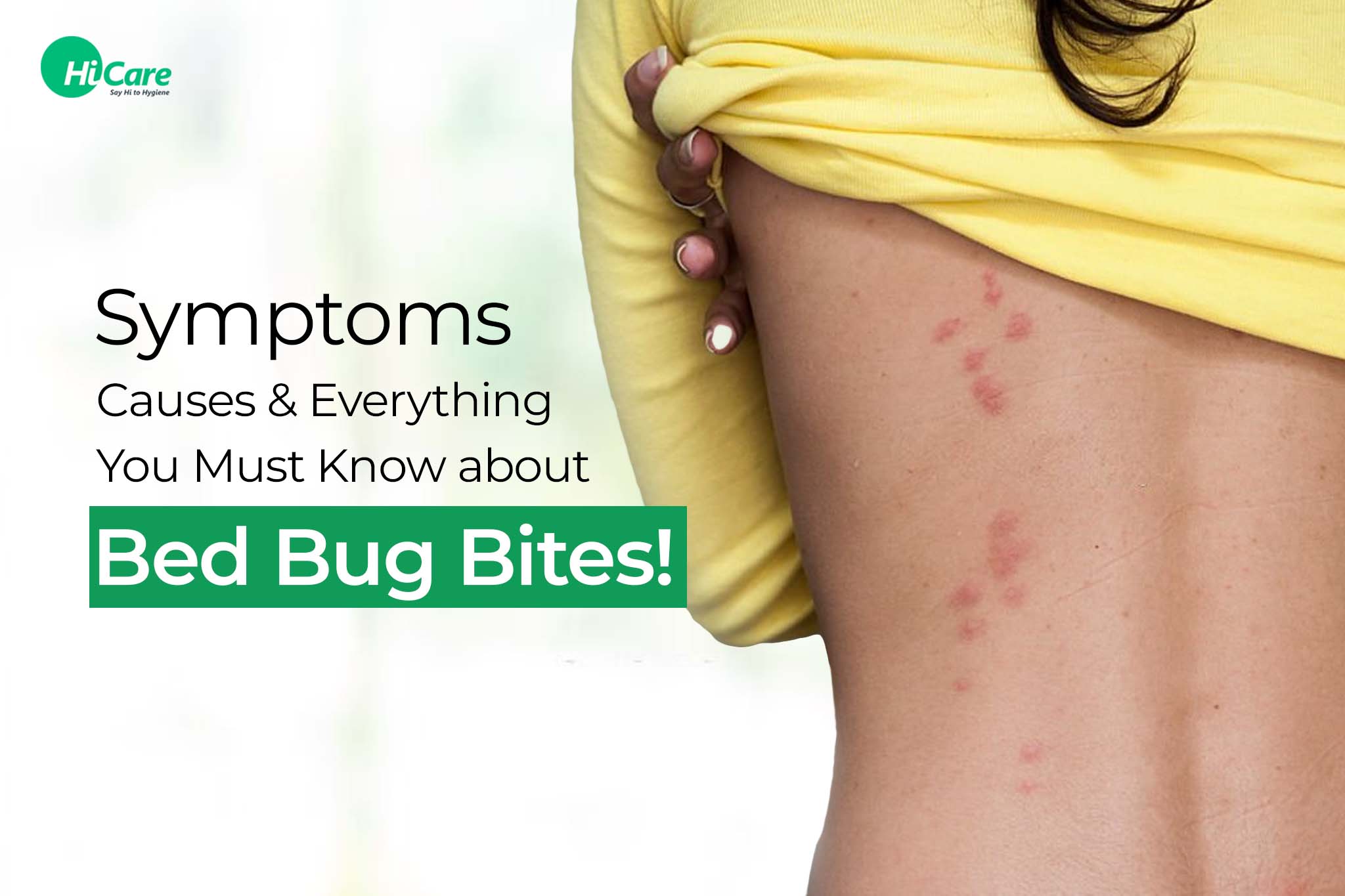 symptoms, causes & everything you must know about bed bug bites
