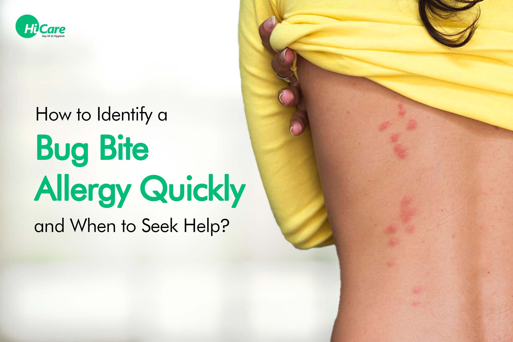 How to Identify a Bug Bite Allergy Quickly and When to Seek Help?