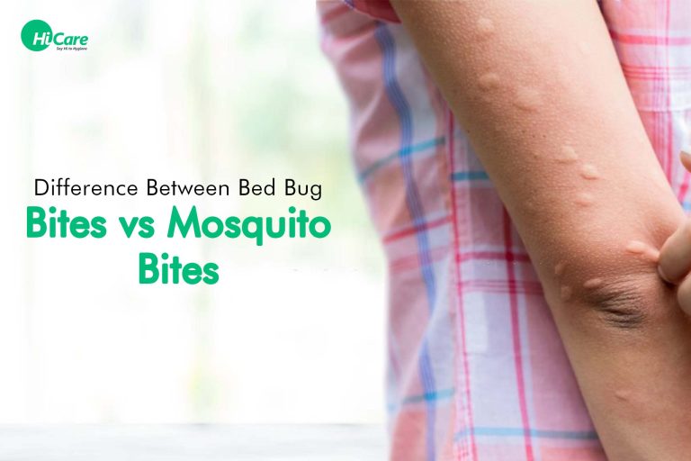 Difference between Bed Bug Bites and Mosquito Bites | HiCare