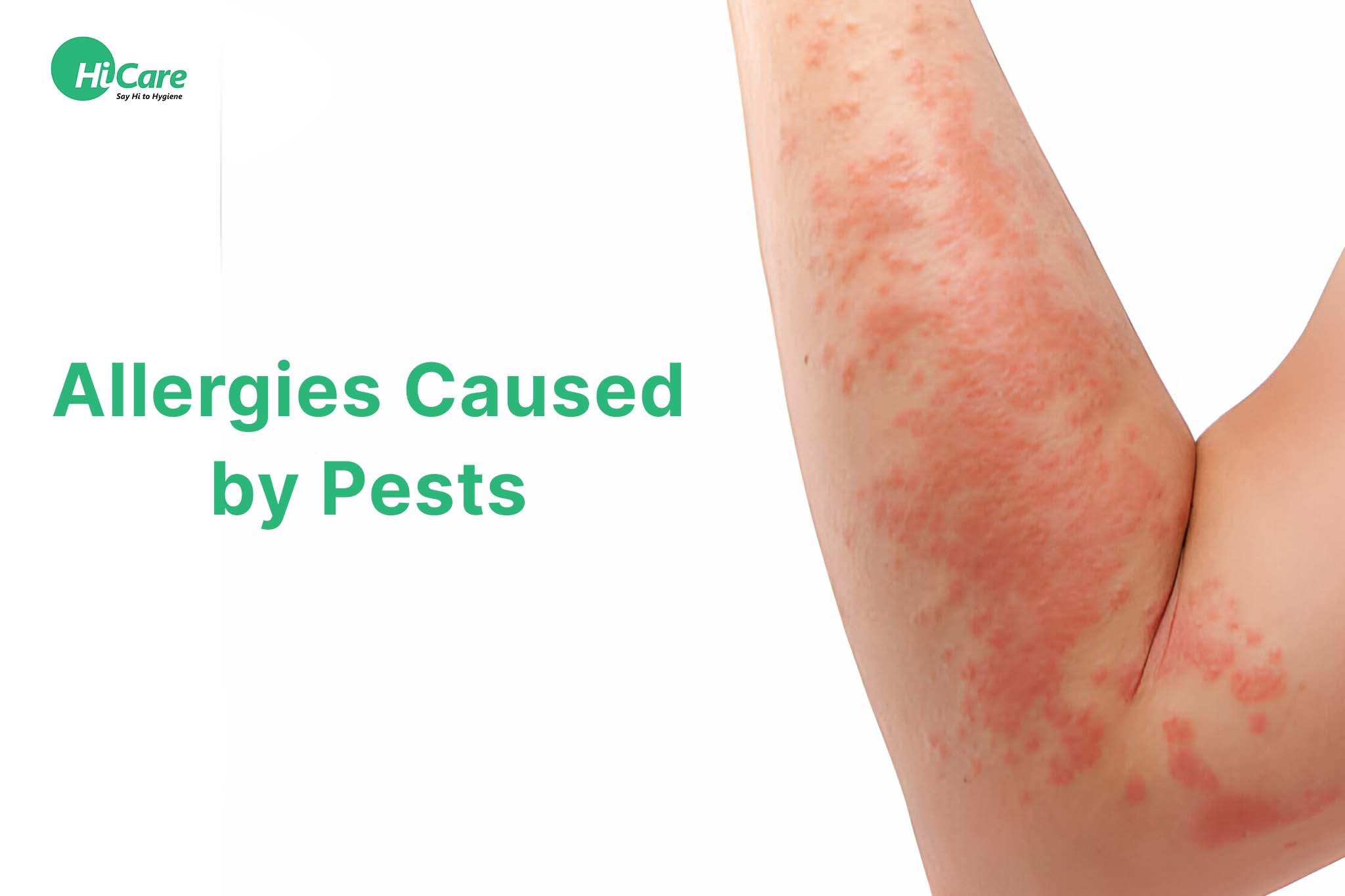 Allergies Caused by Pests
