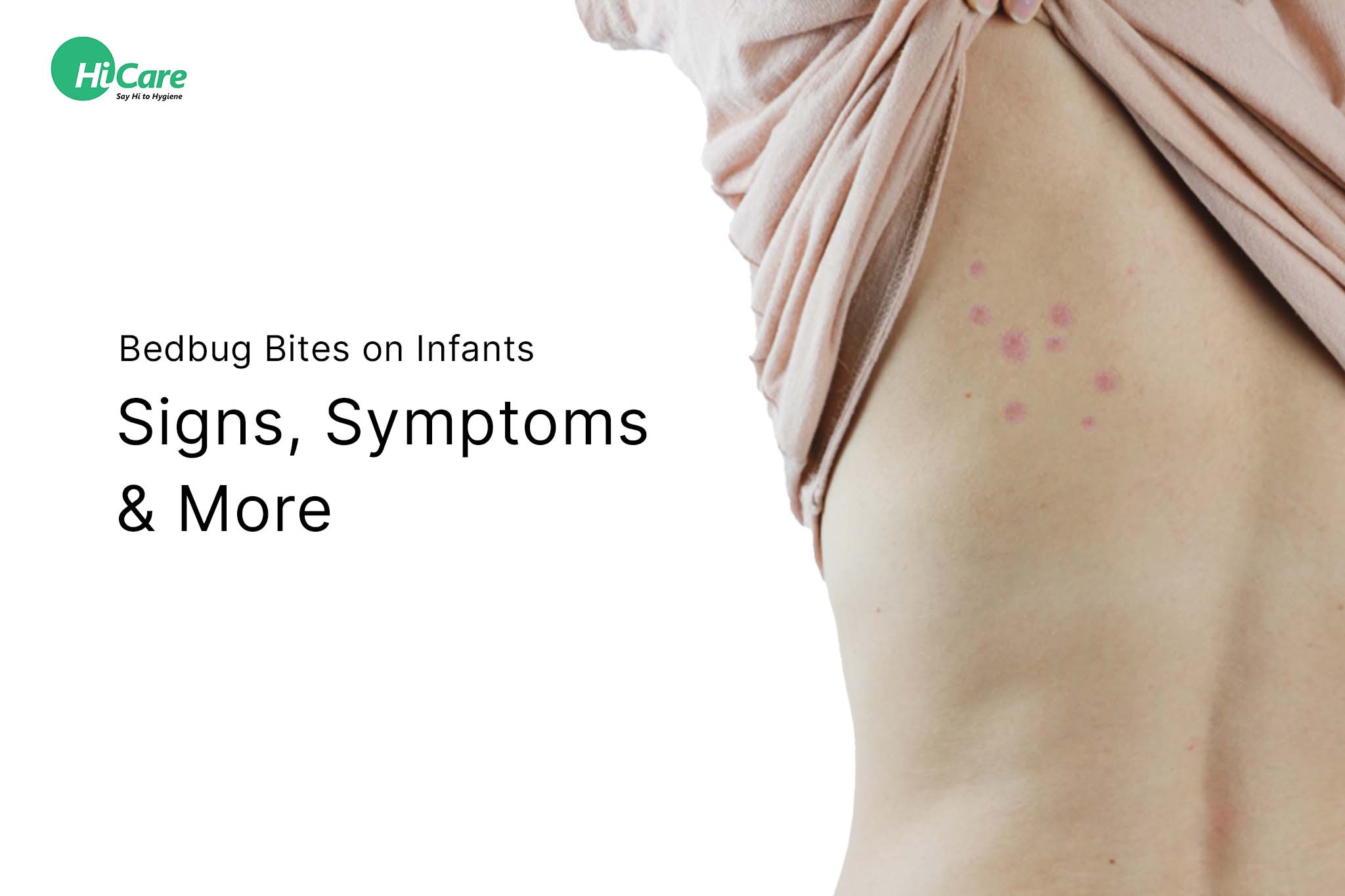 Signs and Symptoms of Bed Bug Bites on Infants | HiCare – HiCare (A ...