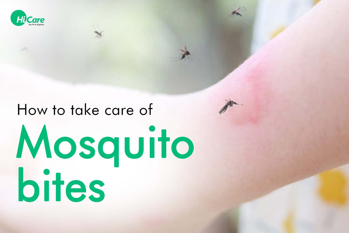How to take care of mosquito bites ? – HiCare (A Rentokil PCI Company)