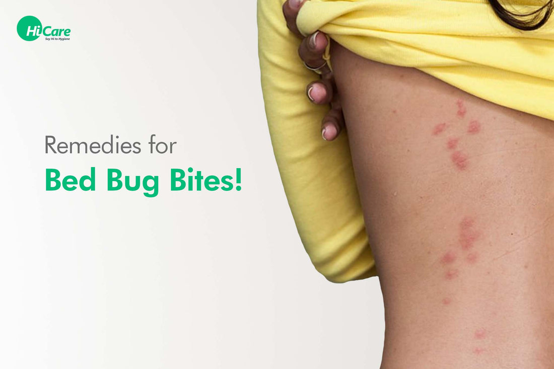 15 Natural Home Remedies for Bed Bug Bites Treatment